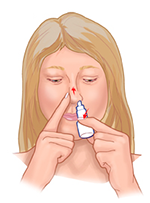 How to Use Nasal Sprays Properly